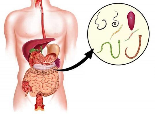 Nemanex eliminates parasites